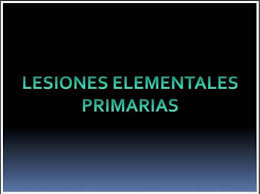 No solevantadas (cambios de color) y solevantadas (sólidas o de contenido líquido). Lesiones Elementales Lesiones Siempre Rojos Mexico Facebook