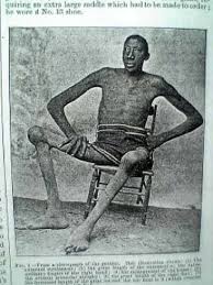 Pai cel mai inalt munte din lume este muntele everest. Top 10 Cei Mai InalÅ£i Oameni Din Lume Si Povestile Lor