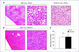 The Tumorigenic Diet Ain 93g M Causes Fatty Liver Disease In A J Mice Download Scientific Diagram