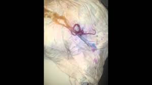 After all, it'll take about 25 washings. How To Remove Splat Hair Color Youtube