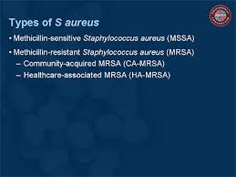The symptoms can present differently depending on which part of the body is infected. Community Acquired And Healthcare Associated Mrs