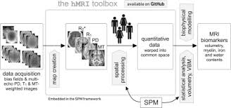 Complete spm tips 2015 & spm trial papers the most complete and updated list of spm 2015 trial papers and spm tips 2015 (kertas soalan percubaan spm 2015 dan tip spm this post will be updated regularly, please check often. Hmri A Toolbox For Quantitative Mri In Neuroscience And Clinical Research Sciencedirect