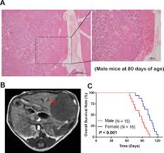Here are some more great taiwan female names you may find. A Method To Establish A C Myc Transgenic Mouse Model Of Hepatocellular Carcinoma Sciencedirect