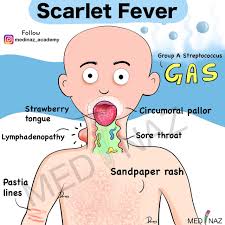 Image result for Scarlet Fever