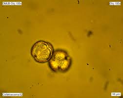 Image result for Colletoecema