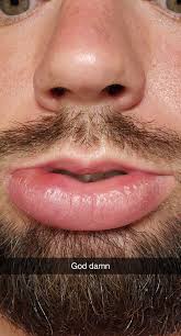 How much does snake bites piercing hurt? Snake Bites Infected Piercing