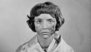 Eyes without a face represents the unimaginable pain of living without a face while they still have eyes to see and keep track in incoming people in the way. Eyes Without A Face Georges Franju 1960 Senses Of Cinema