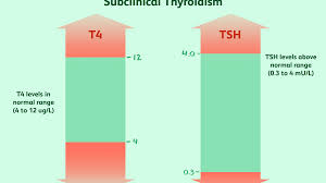 Why Subclinical Hypothyroidism May Increase Heart Disease Risk
