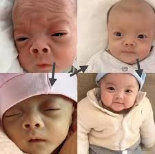 Muka bayi baru lahir merah. Viral Karena Wajah Keriput Saat Baru Lahir Perubahan Pada Bayi Ini Dalam Beberapa Bulan Gemparkan Media Sosial Grid Id Line Today