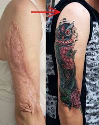Maybe there is a specific image that symbolizes something significant in their lives. 21 Times People Turned To Tattoos To Cover Up Their Scars It Worked Wonderfully