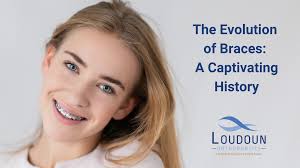 The Evolution of Braces: A Captivating History