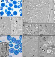 Aştept să văd…vii sau nu? Identification Of Novel Superoxide Dismutase Isoenzymes In The Olive Olea Europaea L Pollen Springerlink