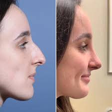 Dr Spencer Cochran (@dallas_rhinoplasty_center) · Instagram 照片和视频