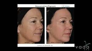 October 13th: Acne facial $55, 30 min cranio massa...