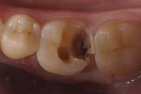 Care sunt cele mai bune lichide pentru organism. Semn De Exclamare Consumator Supraveghea Ce I Bun Pentru Durerea De Masea Apitotal Ro