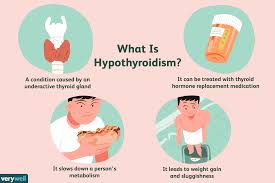 The federal clinical recommendations on diagnostics and treatment of toxic goiter. Thyroid Disease Medications Types And Their Uses