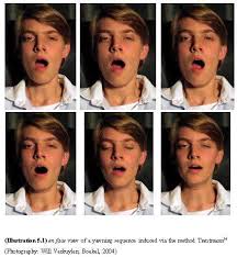 De plus je dois me modre l'intérieur de la joue en mangeant 2 ou 3 fois par jour. Qu Est Ce Qu Un Baillement Et A Quoi Sert Il Dossier