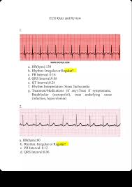Image result for PR Interval