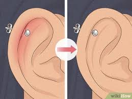 Wait for 15 minutes and r inse with cold water. 5 Ways To Heal Cartilage Piercing Bumps Wikihow