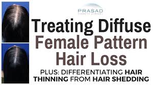 Diffuse hair loss is where there is general hair thinning over the whole scalp and can be attributed to a number of factors such as nutritional deficiencies or illnesses. Female Hair Loss Causes Diagnoses And Treatment New York