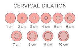 Pakar pendidikan muhammad ramli rahim menilai sekolah tidak bisa dipaksakan untuk melangsungkan sistem belajar tatap muka seperti arahan presiden dan menteri pendidikan, kebudayaan, riset, dan teknologi. Bukaan Rahim 8cm Tanda Ibu Hampir Bersalin Fahami Fasa Kelahiran