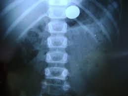 Resultado de imagem para rx imagens