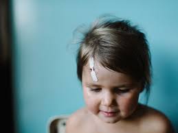 Steri Strips: How to Apply, Care For, Remove