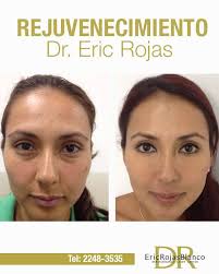 DR. ERIC ROJAS Tel: 2248-3535