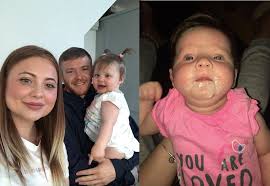 Ask your doctor about other cancer screenings. Parents Spot Baby S Eye Cancer In Picture Taken With A Flash