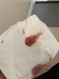 Implantation is a common reason why women bleed before this bleeding is called implantation bleeding or spotting. Implantation Bleed Or Miscarriage Or Neither