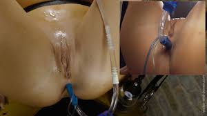 Electro Stimulation and Catheter – Kinkycore: Medical Porn | xHamster