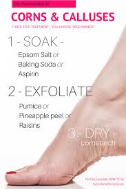 Calluses should be softened enough to be filed with a pumice stone (a rough piece of volcanic it's also recommended to massage the callus for a few minutes with a baking soda paste. How To Permanently Get Rid Of Corns And Calluses Every Home Remedy Corns Pedicure Get Rid Of Corns Corn Treatment Foot Care Diy