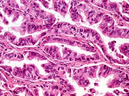 To initially assess this in both small and large avian lung models, chicken (gallus gallus domesticus) and emu. Human Pathology Nikon S Microscopyu