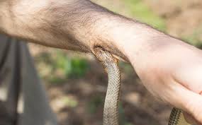 Image result for Snake Bite