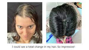 Marcellas More Hair Naturally Before And After Photos And Reviews