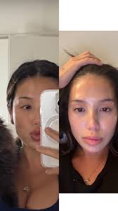 Masseter Muscle Women