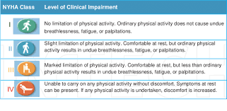 Nyha Stages Of Heart Failure Usdchfchart Com