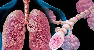Learn more about the types and causes of asthma here. Asthma Facts Symptoms Causes Treatments More