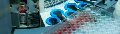 Es ist tatsächlich der einzige sichere weg, um herauszufinden, ob du infiziert bist: Hiv Test Wien Know Your Status Klarheit Unmittelbar Labor Vidotto