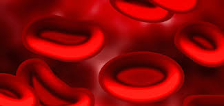 Instead, they clog blood vessels. Sickle Cell Anemia What You Should Know Personalized Hematology Oncology Of Wake Forest