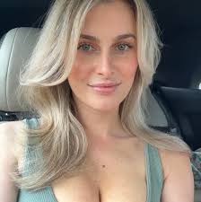 VERY early rhinoplasty & chin implant results ✨ we just couldn't wait to  share! Abigail, our beautiful aesthetician, is pictured before and just 2  weeks after a rhinoplasty and chin implant! She