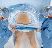 Hemorrhage View C-section Drape | Perspective Medical