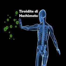 Prediligere prodotti naturalmente privi di glutine come il pane di grano saraceno ed escludere i prodotti confezionati che riportano sulla confezione la scritta senza glutine; Tiroidite Di Hashimoto Alimentazione Epigenetica Come Trattarla
