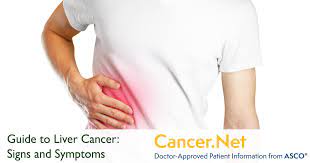 I then had some pain in my lower left quadrant, pain actually hurt down leg and lower back. Liver Cancer Symptoms And Signs Cancer Net