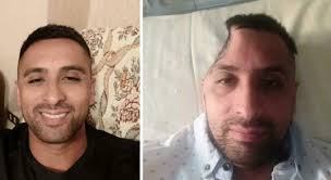 Carlo travolto mentre va in bici a Fermo, i medici gli tolgono un pezzo di  cranio per salvarlo