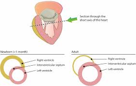 Pediatric Ekg 15 Lead Placement Diagram Wiring Diagrams