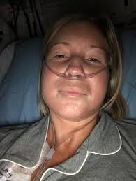 My life is a living hell right now. I don't know how to get things in  order. I am so ugly. Skin no hair woke up leg and knee is swollen. Is