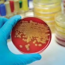 Image result for Stool Culture