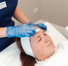 Aesthetic skin clinic Wakefield & Leeds