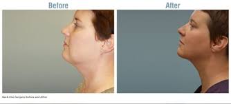 Wolf's Rejuvenation Center, 1 Marty Ln, West Alexandria, OH 45381, US